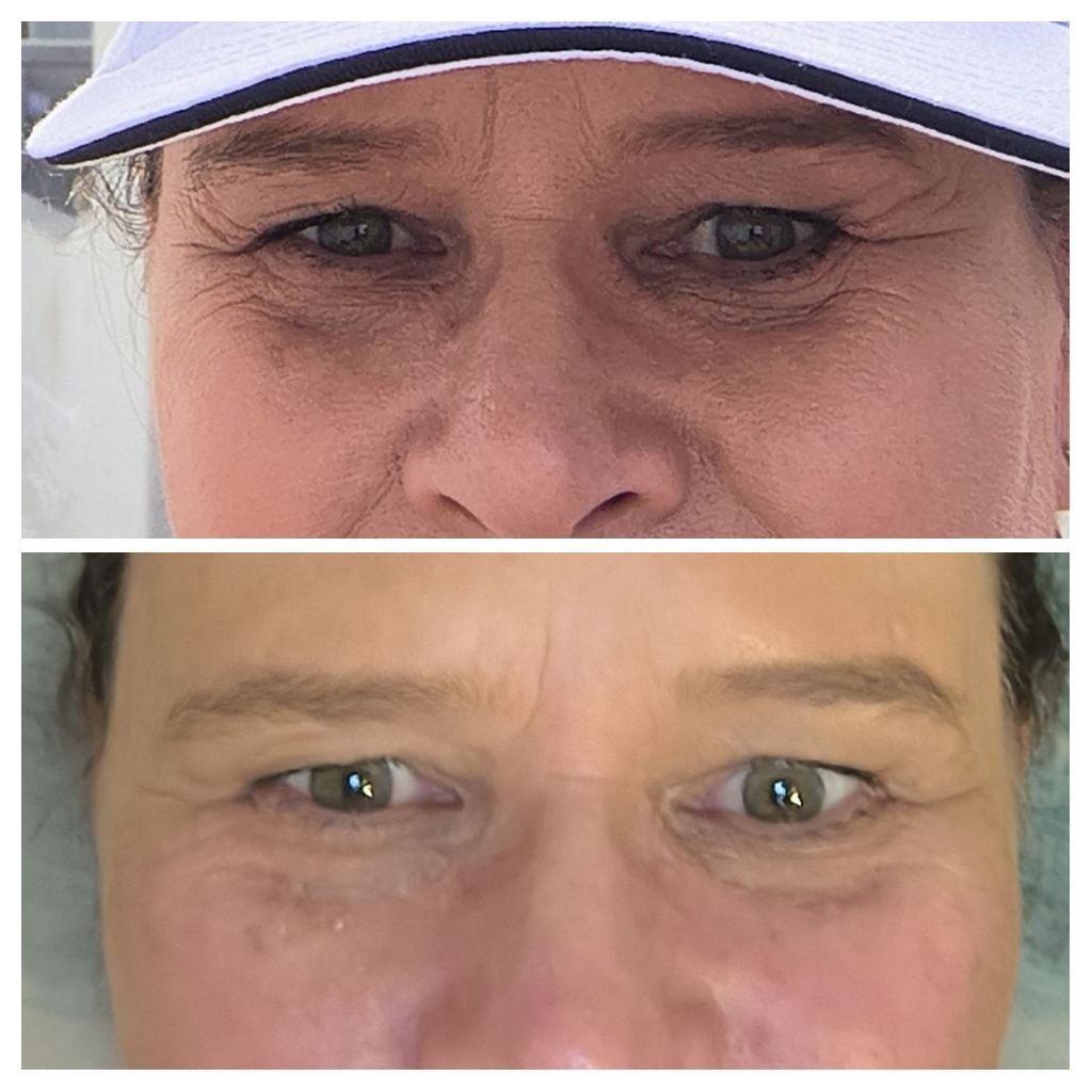 Image #1 from Lee-Anne