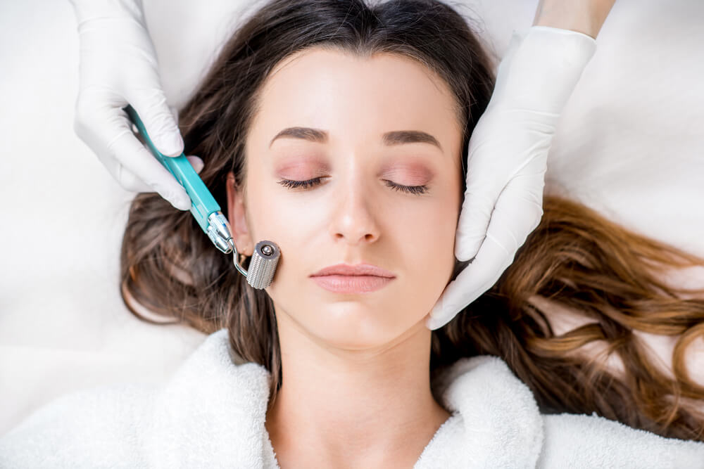 Microneedling on woman