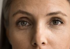 woman tired eyes