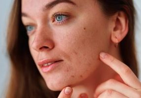 woman sensitive skincare