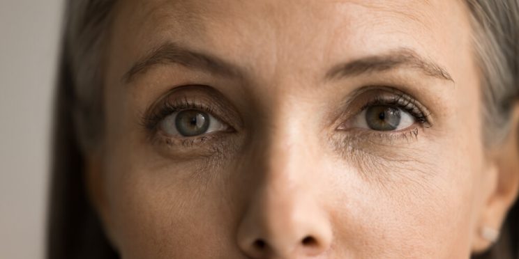 woman tired eyes