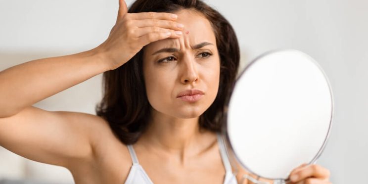 woman skincare concerned